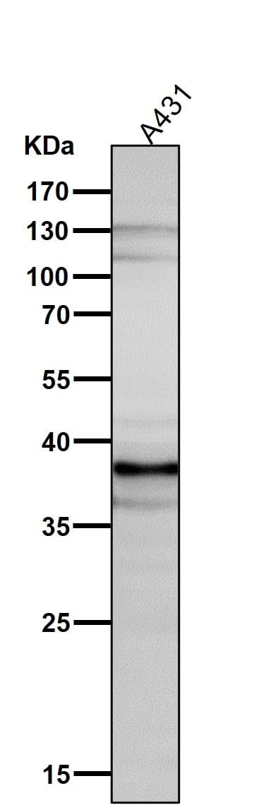 Anti-DKK1 Rabbit Monoclonal Antibody Boster Bio