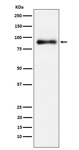 Anti-Lactoferrin Rabbit Monoclonal Antibody Boster Bio
