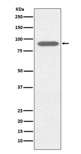 Anti-Lactoferrin LTF Rabbit Monoclonal Antibody Boster Bio