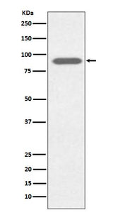 Anti-Lactoferrin LTF Rabbit Monoclonal Antibody Boster Bio