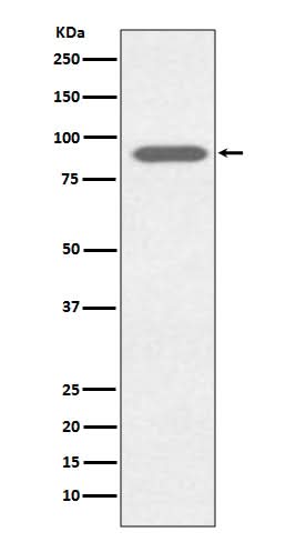 Anti-Lactoferrin LTF Rabbit Monoclonal Antibody Boster Bio