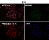 Anti-PRMT5 Rabbit Monoclonal Antibody Boster Bio