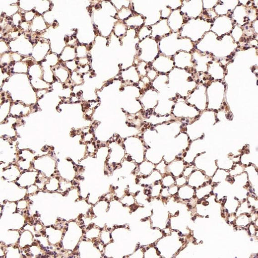 Anti-JAG1 Rabbit Monoclonal Antibody Boster Bio