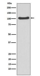 Anti-MVP Rabbit Monoclonal Antibody Boster Bio