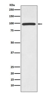 Anti-HMGCR/Hmg Coa Reductase Rabbit Monoclonal Antibody Boster Bio