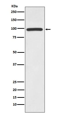 Anti-HMGCR/Hmg Coa Reductase Rabbit Monoclonal Antibody Boster Bio