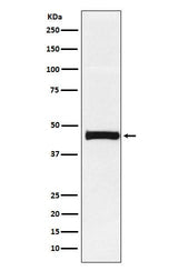 Anti-Pentraxin 3 Rabbit Monoclonal Antibody Boster Bio