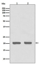 Anti-IL1RA Rabbit Monoclonal Antibody Boster Bio