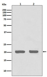 Anti-IL1RA Rabbit Monoclonal Antibody Boster Bio