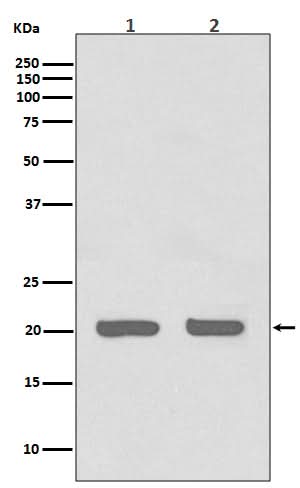 Anti-IL1RA Rabbit Monoclonal Antibody Boster Bio
