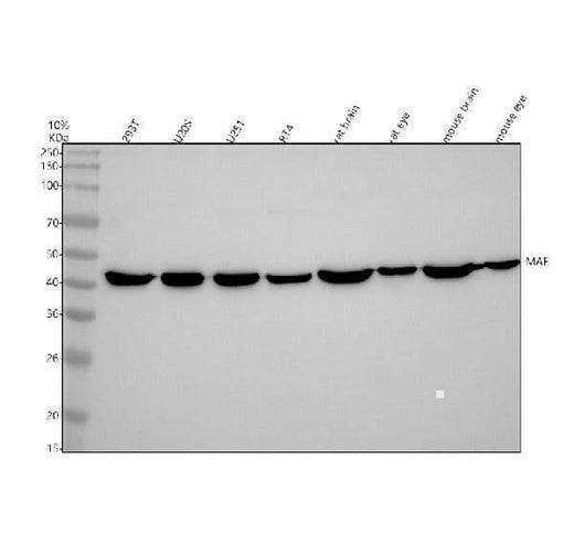 Anti-c-Maf Rabbit Monoclonal Antibody Boster Bio