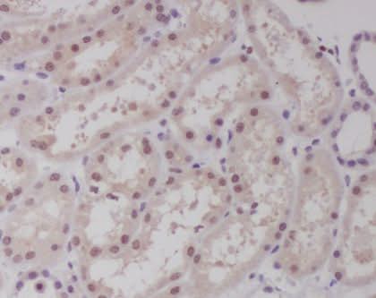 Anti-c-Maf Rabbit Monoclonal Antibody Boster Bio