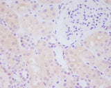 Anti-MMP14/Mt1 Mmp Rabbit Monoclonal Antibody Boster Bio