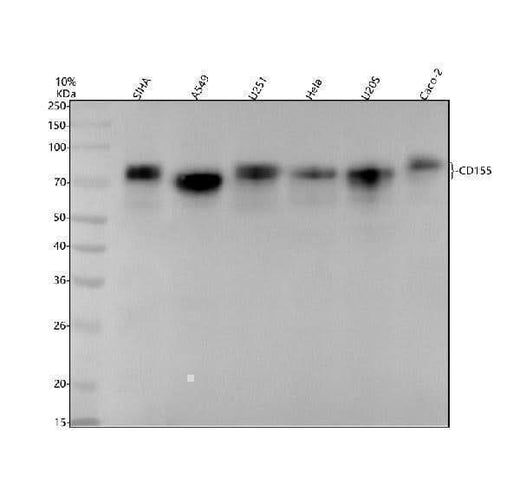 Anti-Poliovirus Receptor Rabbit Monoclonal Antibody Boster Bio