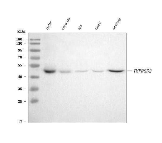 Anti-TMPRSS2 Rabbit Monoclonal Antibody Boster Bio