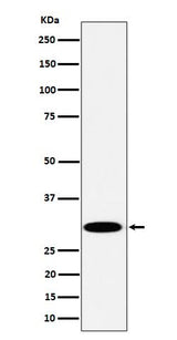 Anti-TPMT Rabbit Monoclonal Antibody Boster Bio