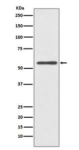 Anti-CYP2E1 Rabbit Monoclonal Antibody Boster Bio