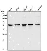 Anti-SGK1/Sgk Rabbit Monoclonal Antibody Boster Bio