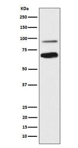 Anti-TCF4 Rabbit Monoclonal Antibody Boster Bio