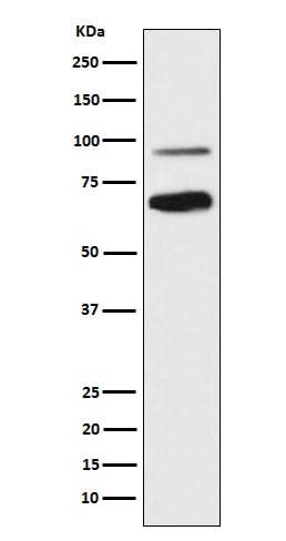 Anti-TCF4 Rabbit Monoclonal Antibody Boster Bio