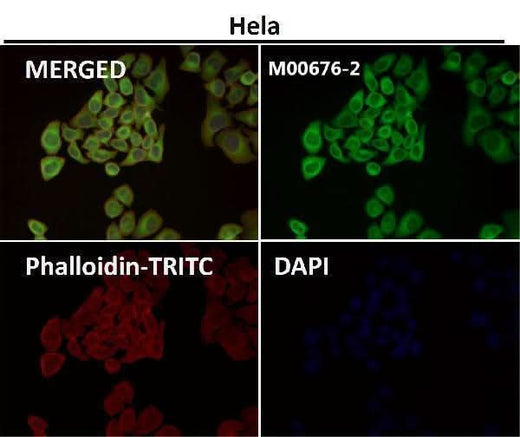 Anti-Hsp27 HSPB1 Rabbit Monoclonal Antibody Boster Bio
