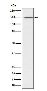Anti-phospho-Phospholipase C gamma 1/PLC-gamma-1 (Y1253) Rabbit Monoclonal Antibody Boster Bio