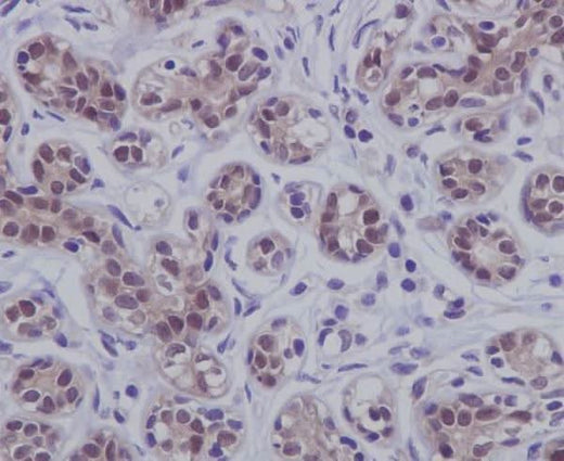 Anti-STAT5b Rabbit Monoclonal Antibody Boster Bio
