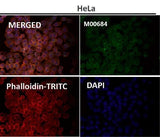 Anti-Fyn Rabbit Monoclonal Antibody Boster Bio