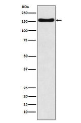 Anti-ATP7b Rabbit Monoclonal Antibody Boster Bio
