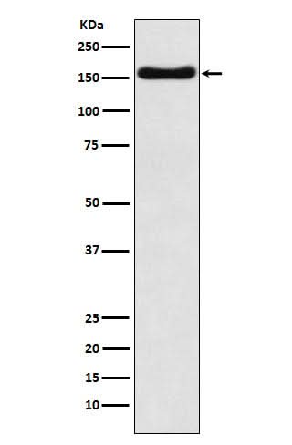 Anti-ATP7b Rabbit Monoclonal Antibody Boster Bio