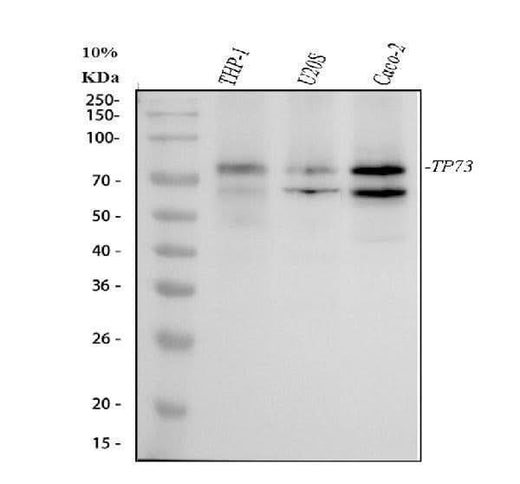Anti-p73 Rabbit Monoclonal Antibody Boster Bio