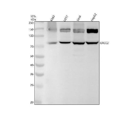 Anti-XPD Rabbit Monoclonal Antibody Boster Bio