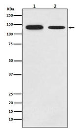 Anti-Growth hormone receptor Rabbit Monoclonal Antibody Boster Bio