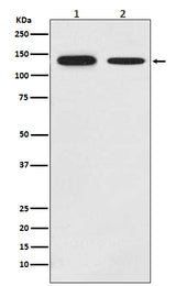 Anti-Growth hormone receptor Rabbit Monoclonal Antibody Boster Bio