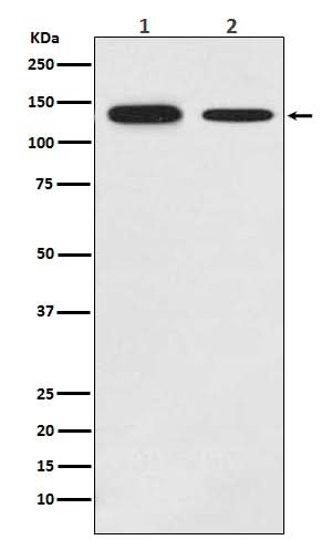 Anti-Growth hormone receptor Rabbit Monoclonal Antibody Boster Bio