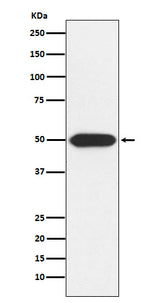 Anti-PRKAR1A Rabbit Monoclonal Antibody Boster Bio