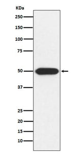 Anti-PRKAR1A Rabbit Monoclonal Antibody Boster Bio