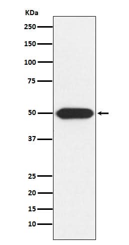 Anti-PRKAR1A Rabbit Monoclonal Antibody Boster Bio