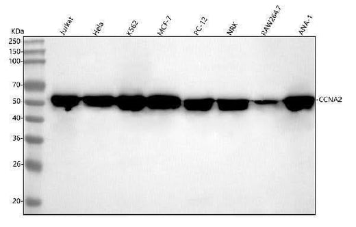Anti-Cyclin A2 Rabbit Monoclonal Antibody Boster Bio
