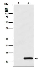 Anti-CCL4/MIP1 beta Rabbit Monoclonal Antibody Boster Bio