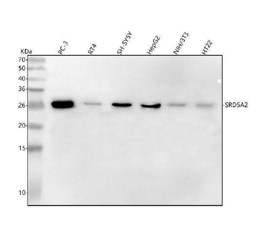 Anti-SRD5A2 Rabbit Monoclonal Antibody Boster Bio