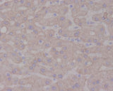 Anti-TrkA NTRK1 Rabbit Monoclonal Antibody Boster Bio