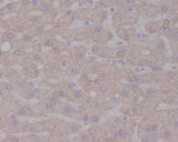 Anti-TrkA NTRK1 Rabbit Monoclonal Antibody Boster Bio