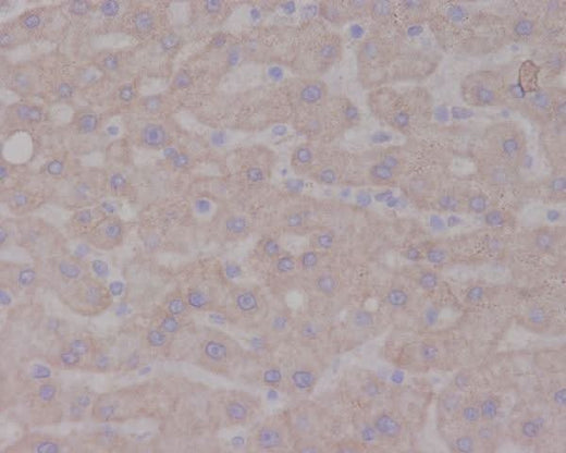 Anti-TrkA NTRK1 Rabbit Monoclonal Antibody Boster Bio