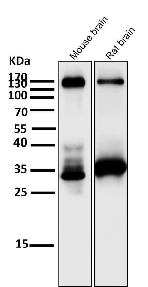 Anti-TrkA+B+C NTRK1 Rabbit Monoclonal Antibody Boster Bio