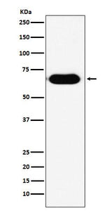 Anti-RNF8 Rabbit Monoclonal Antibody Boster Bio