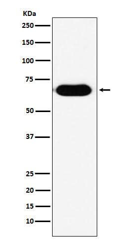 Anti-RNF8 Rabbit Monoclonal Antibody Boster Bio