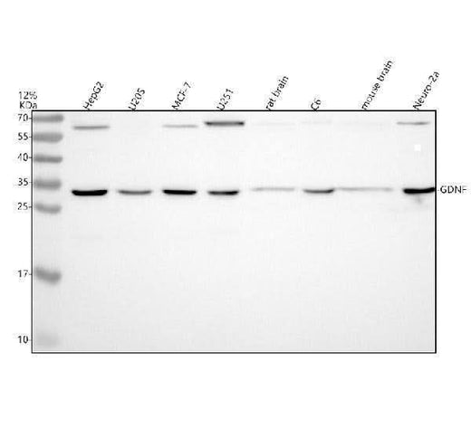 Anti-GDNF Rabbit Monoclonal Antibody Boster Bio