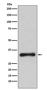 Anti-Emerin Rabbit Monoclonal Antibody Boster Bio