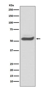 Anti-SERPINA1/Alpha 1 Antitrypsin Rabbit Monoclonal Antibody Boster Bio